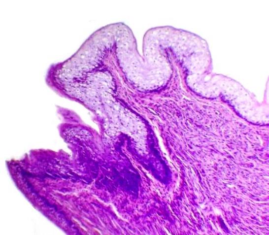 Figura 3 - Epitelio que recubre el extremo del pezn y el que reviste a un conducto, obsrvese la vacuolizacin del citoplasma. Hematoxilina y eosina. 200X.